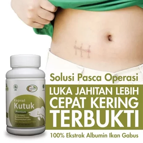 Cara Tepat Menggunakan Obat Kutuk Prime agar Hasil Optimal